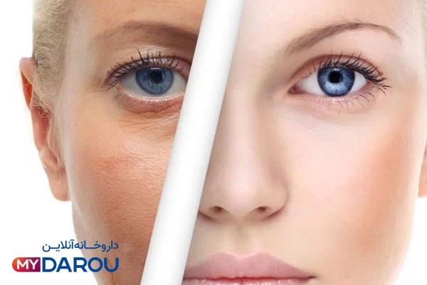 بهترین کرم لایه بردار 